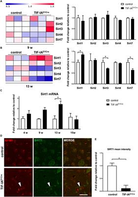 Integration of the Deacetylase SIRT1 in the Response to Nucleolar Stress: Metabolic Implications for Neurodegenerative Diseases